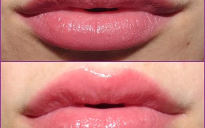 Natural Lips 700x441 1