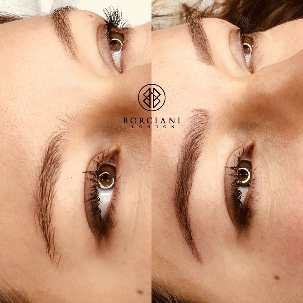 Microblading