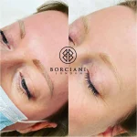 Microblading Removal Saline