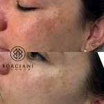 Pigmentation