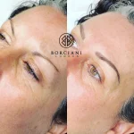 Permanent Makeup Brows