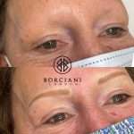 Permanent Makeup Brows Alopecia