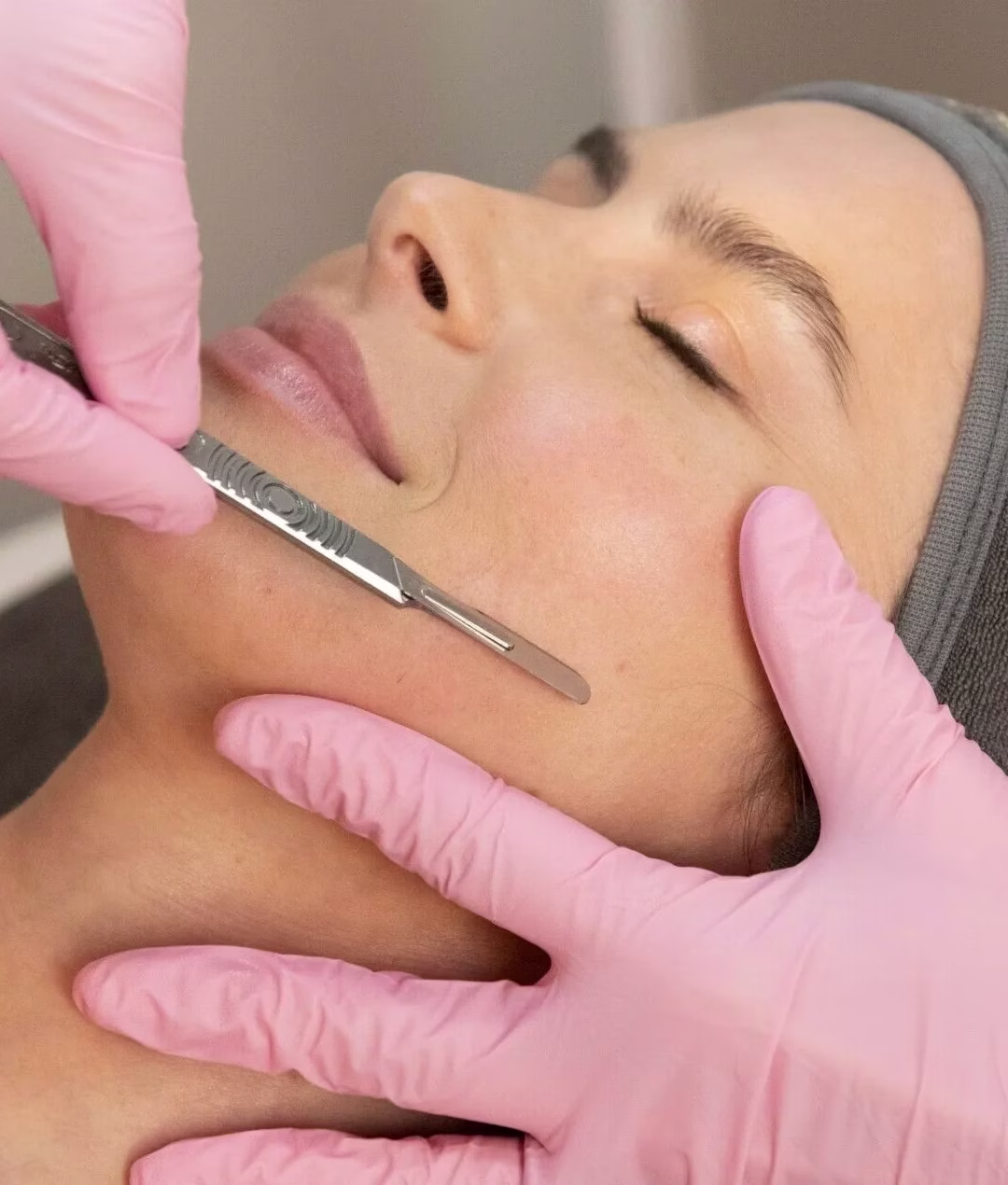 Dermaplaning-e18c5545-1920w