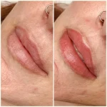 Lip Blush Treatment Before and after