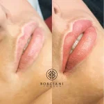 Lip Blush Treatment Before and after