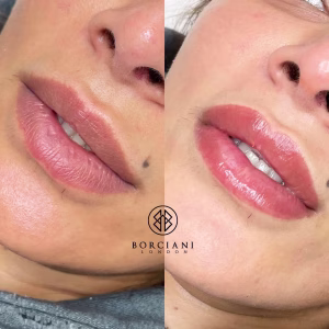 Lip Blush Treatment Before and after