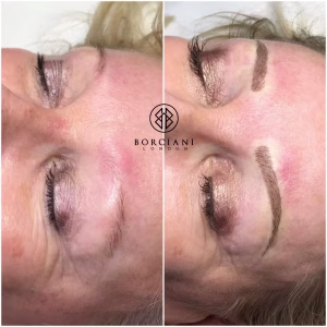 Permanent Makeup Brows