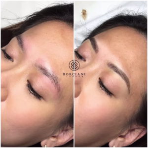 Permanent Makeup Brows