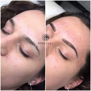 Permanent Makeup Brows