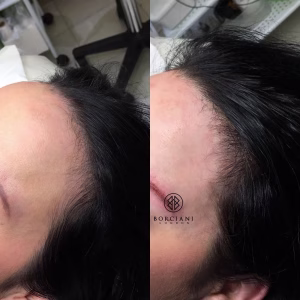 Hair Loss Treatment