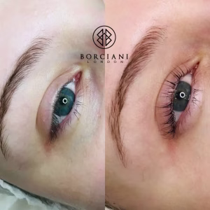 lash enhancement