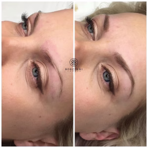 Permanent Makeup Brows