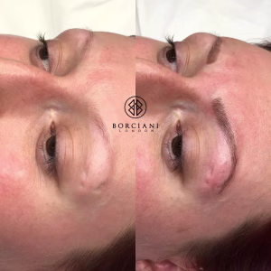 Permanent Makeup Brows
