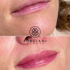 Lip Blush Treatment Before and after
