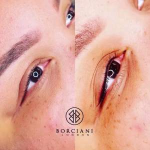 Permanent eyeliner