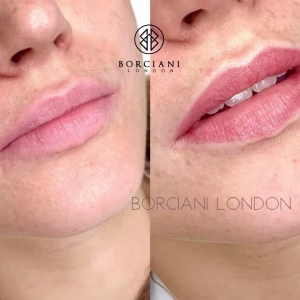 Lip Blush Treatment Before and after