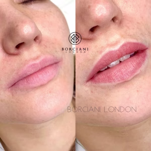 Lip Blush Treatment Before and after