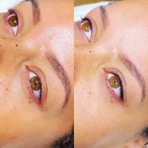 permanent eyeliner