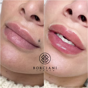 Lip Blush Treatment Before and after