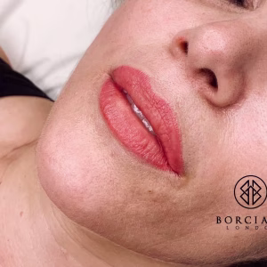 Lip Blush Treatment Before and after