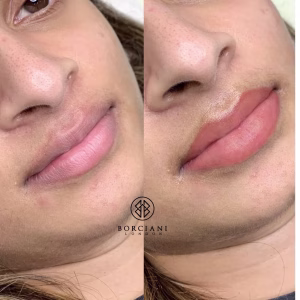 Lip Blush Treatment Before and after