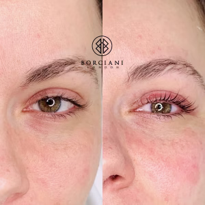 lash enhancement