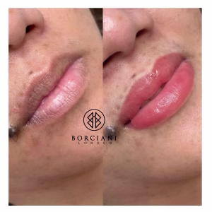 Lip Blush Treatment Before and after