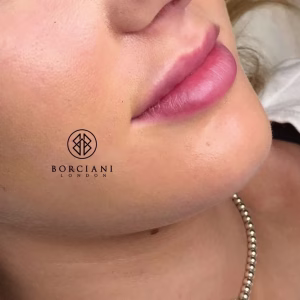 Lip Blush Treatment