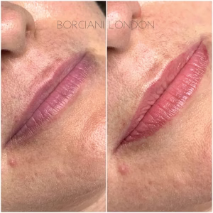 Lip Blush Treatment Before and after