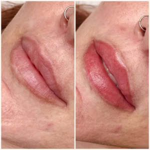 Lip Blush Treatment Before and after