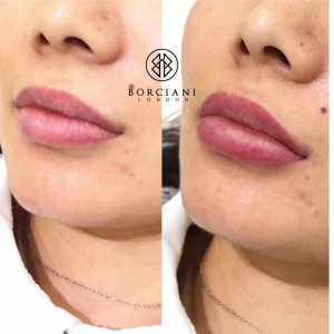 Lip Blush Treatment Before and after