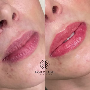 Lip Blush Treatment Before and after