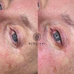 permanent eyeliner