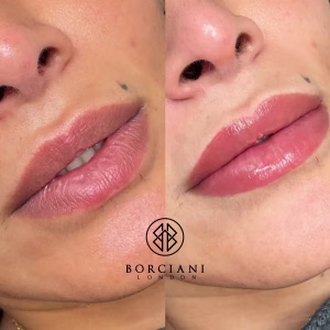 Lip Blush Treatment Before and after