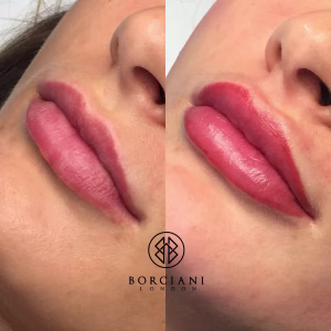 Lip Blush Treatment Before and after