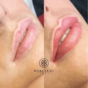 Lip Blush Treatment Before and after