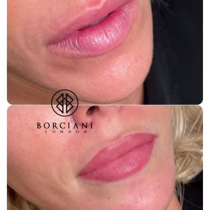 Lip Blush Treatment Before and after