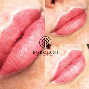 Lip Blush Treatment Before and after