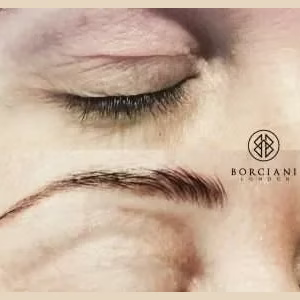 Eyelid Tightening