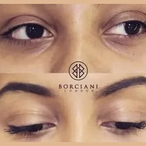 Under Eye Brightening